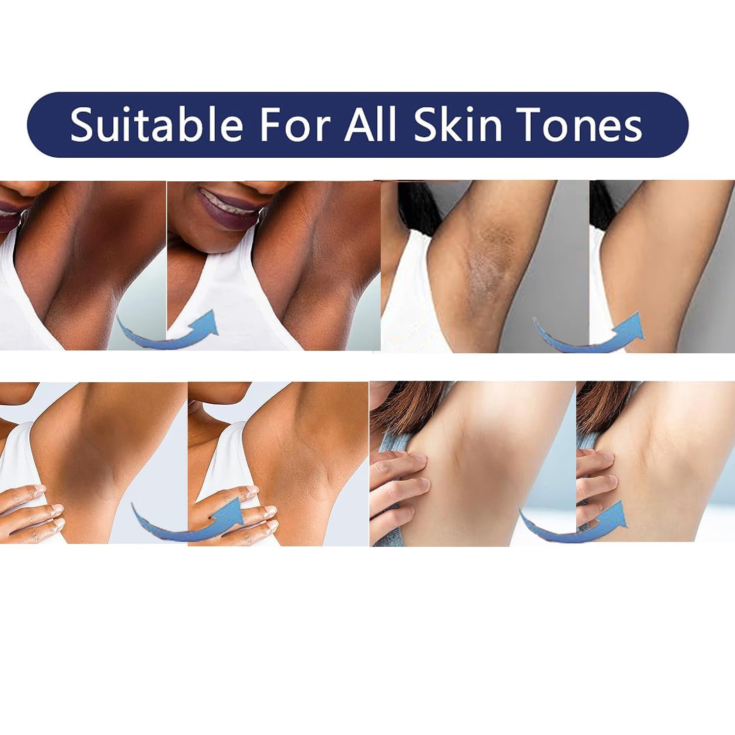 Skin Bleaching Cream For Body Intimate Area Skin Whitening Cream Skin Lightening Cream For Intimate Area, Private Parts, Underarm, Knees, Elbows, Inner Thigh, Bikini Areas